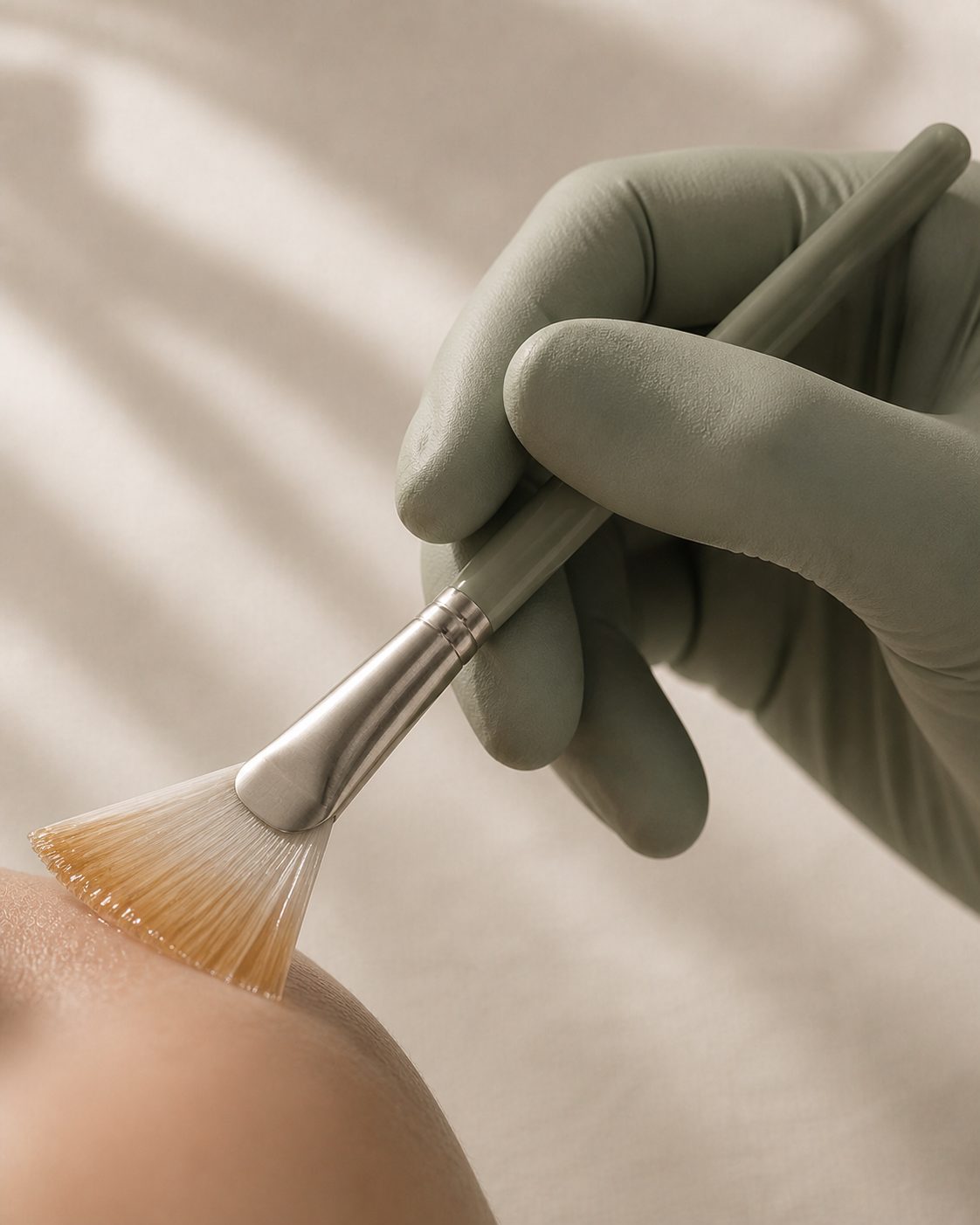 Chemical Peels